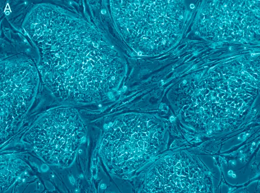 Comment optimiser les résultats de votre thérapie par cellules souches ?