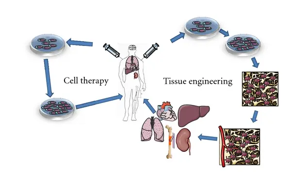 Un schéma illustrant le processus de la thérapie par cellules souches