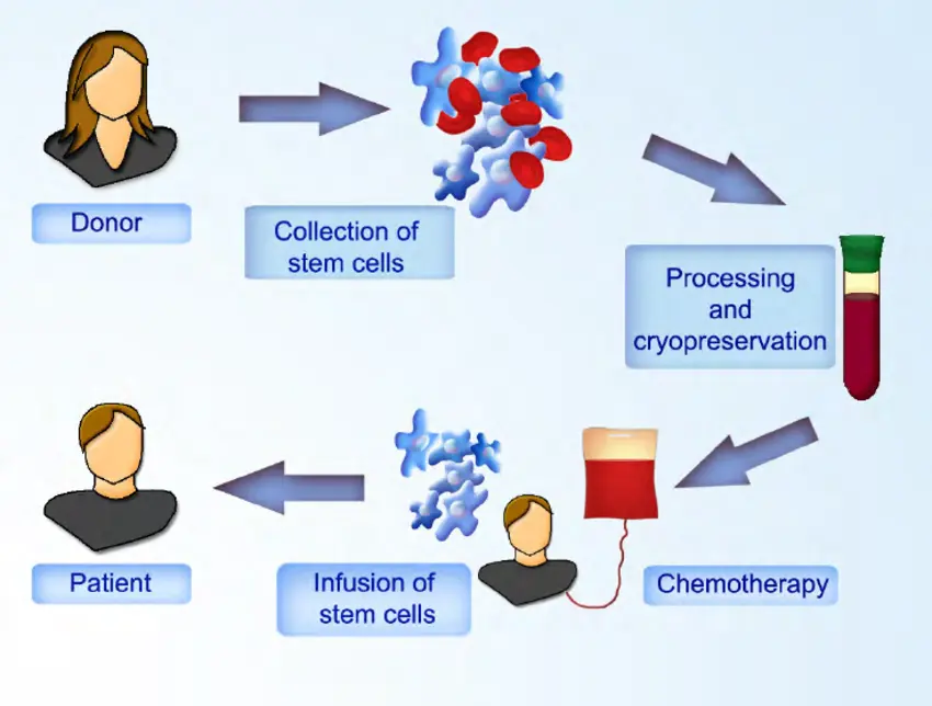 transplantation de cellules souches