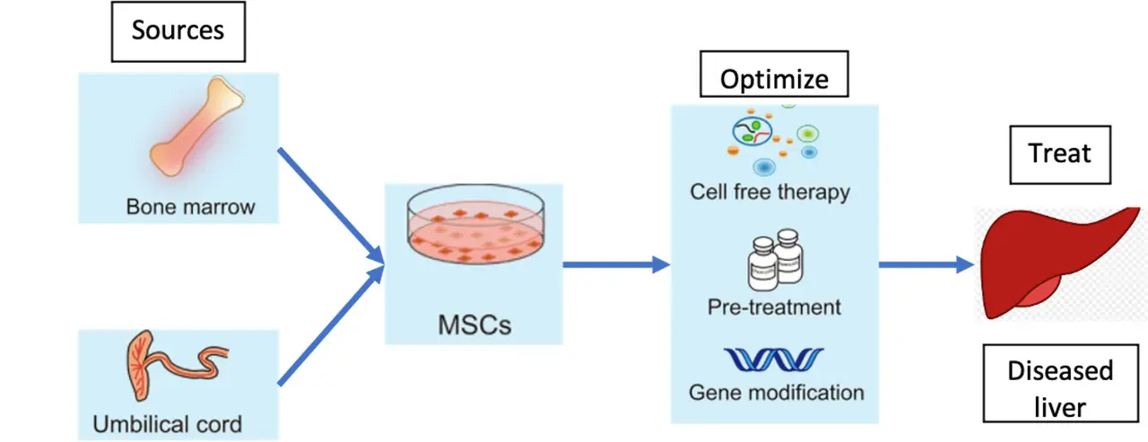 Un schéma illustrant le processus du traitement par cellules souches pour les maladies du foie