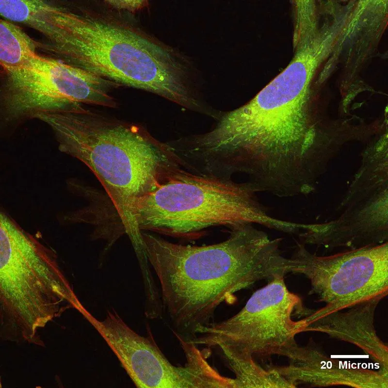 UCMSC Cellule Souche