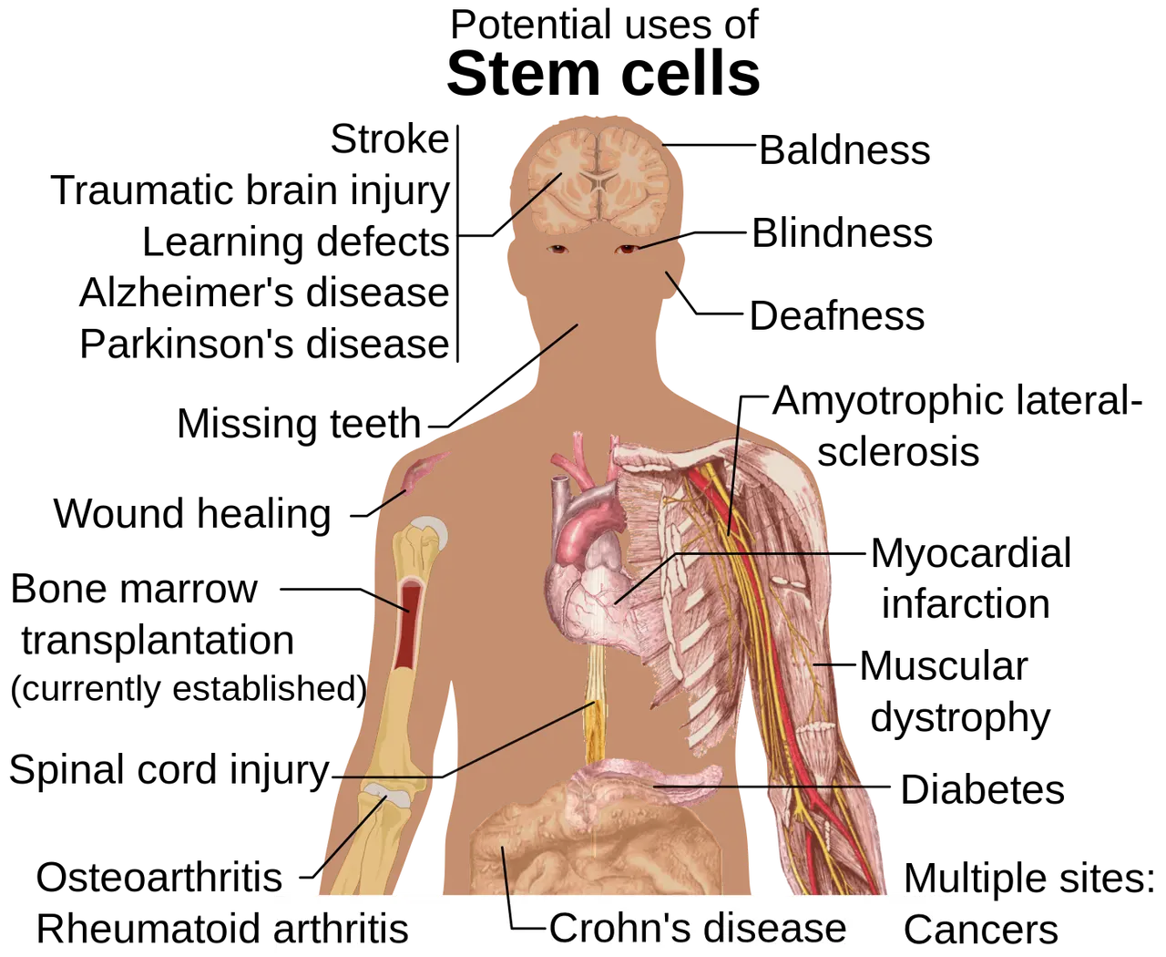 applications potentielles de la thérapie par cellules souches et de la médecine régénérative dans diverses affections.