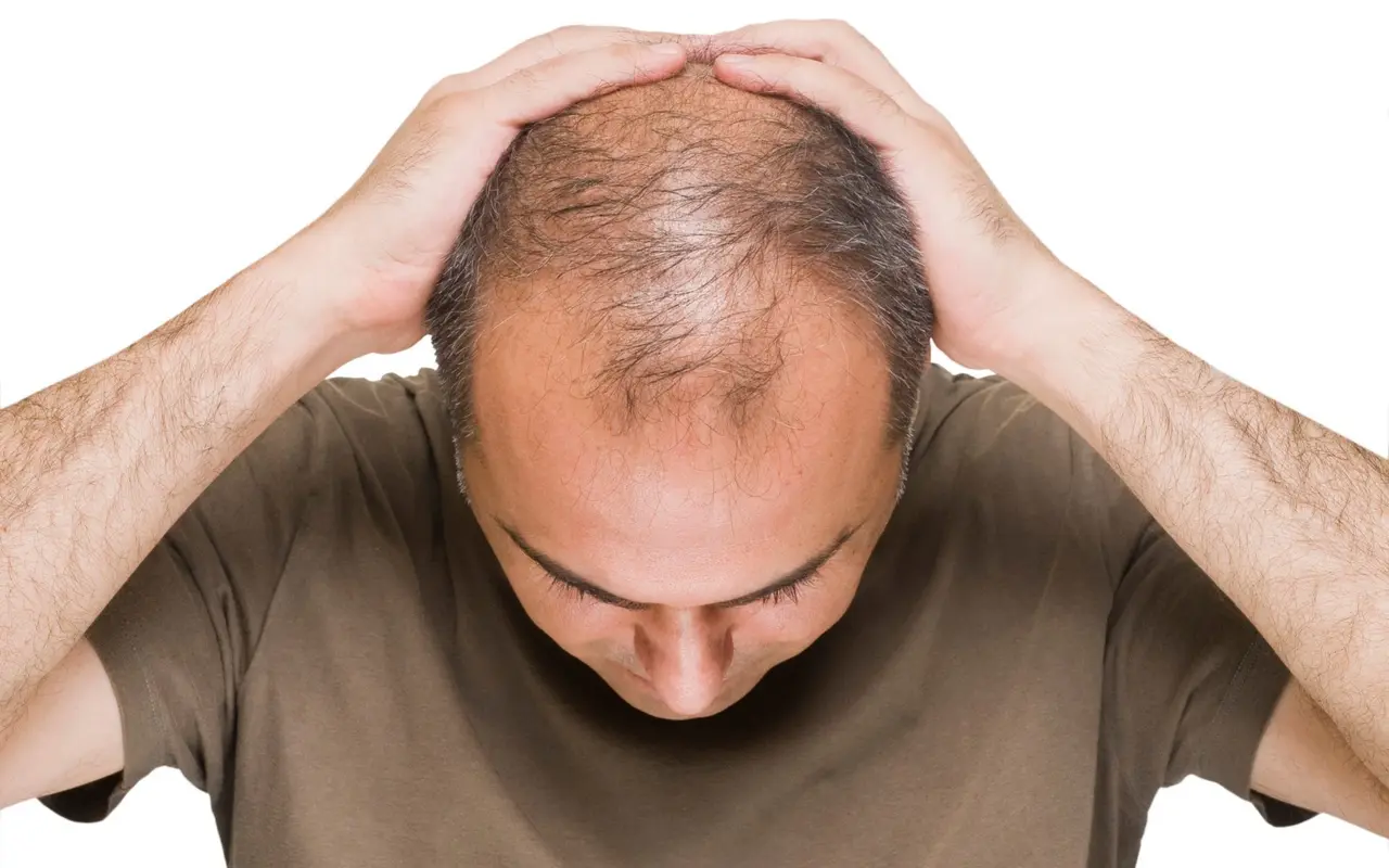 Le potentiel de la thérapie par cellules souches pour la perte de cheveux