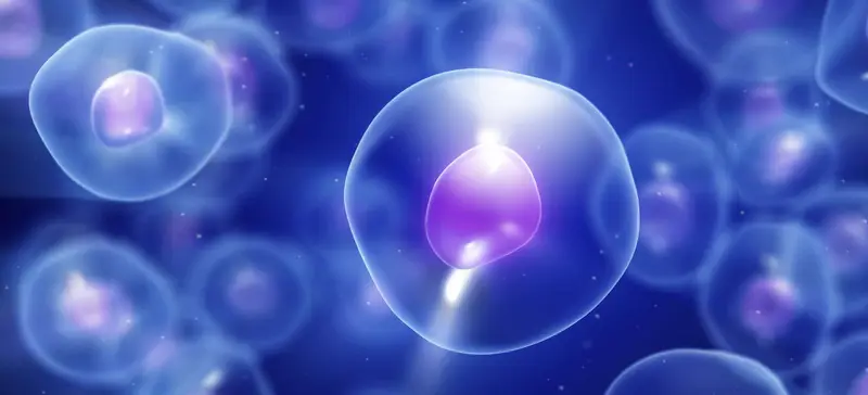 Traitement des lésions cérébrales avec les cellules souches de sang de cordon
