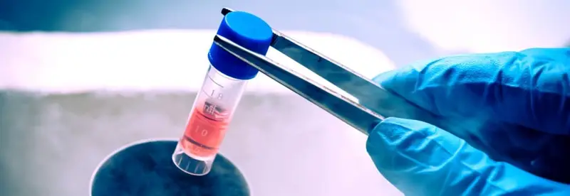 Thérapie par cellules souches pour la maladie de Crohn approuvée en Europe