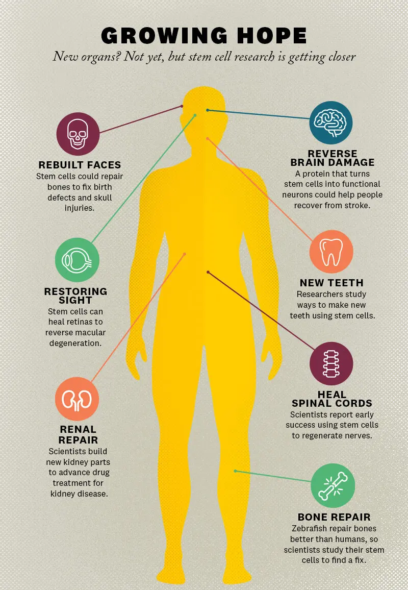 Une infographie illustrant comment les cellules souches peuvent être utilisées dans les thérapies anti-vieillissement