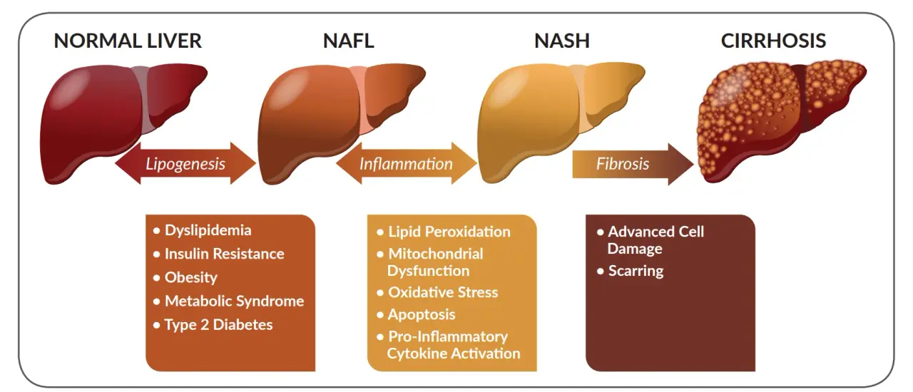 Un graphique illustrant les différents types de maladies du foie et leur impact potentiel sur la santé